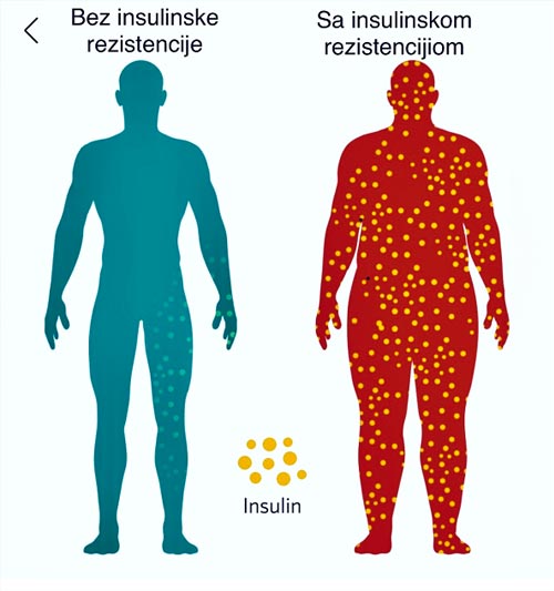 Kolegium Medic Beograd - Insulinska Rezistencija