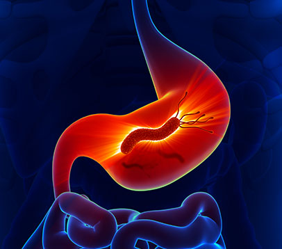 Helicobacter Pilori - Gastroenterolog - Kolegium Medic