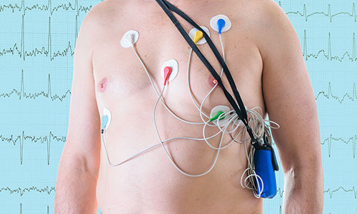 Holter EKG - Kolegium Medic