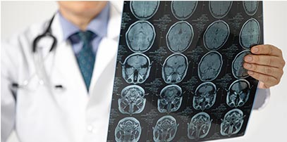 Neurološki pregled - Kolegium Medic