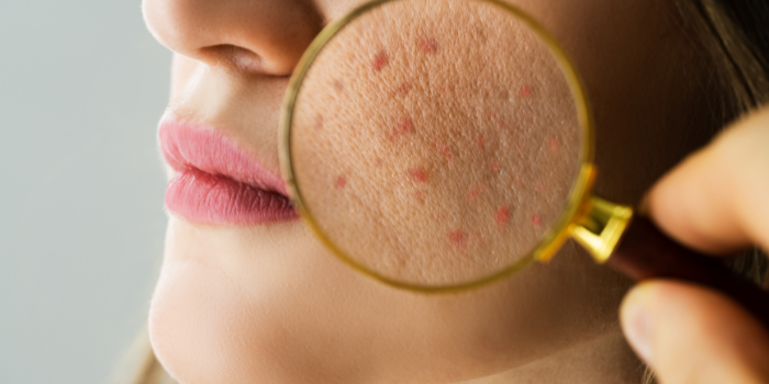 Dermatologija